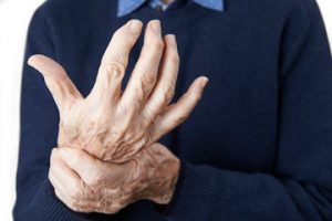 Role of Steroids in Treatment of Arthritis